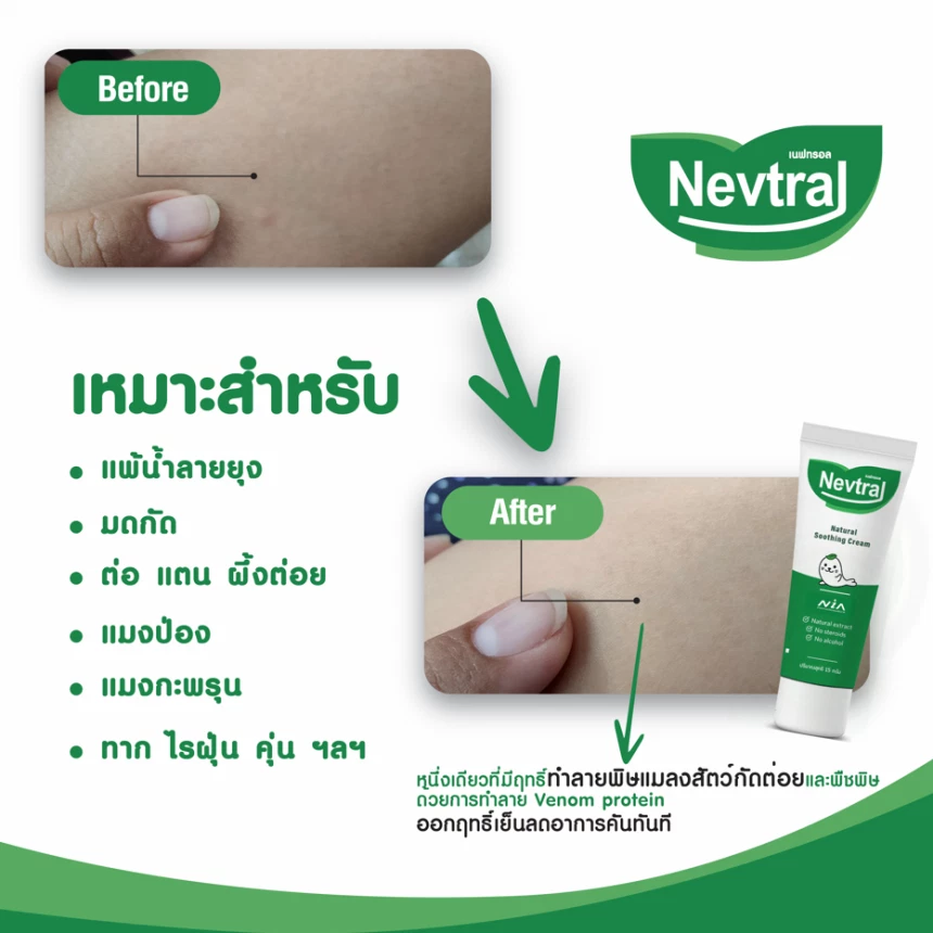 เนฟทรอล ครีม จากสารสกัดธรรมชาติ สำหรับแก้แพ้ ผดผื่นคัน แมลงสัตว์กัดต่อย สูตรอ่อนโยน 15g.