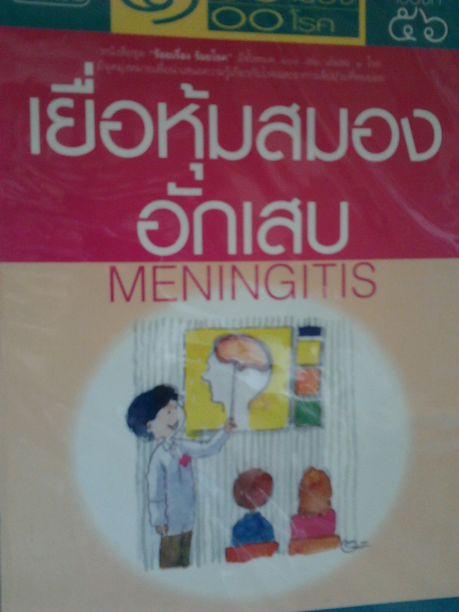 เยื่อหุ้มสมองอักเสบ