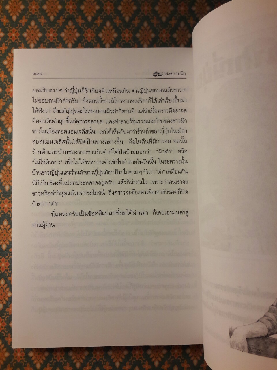 สงครามผิว