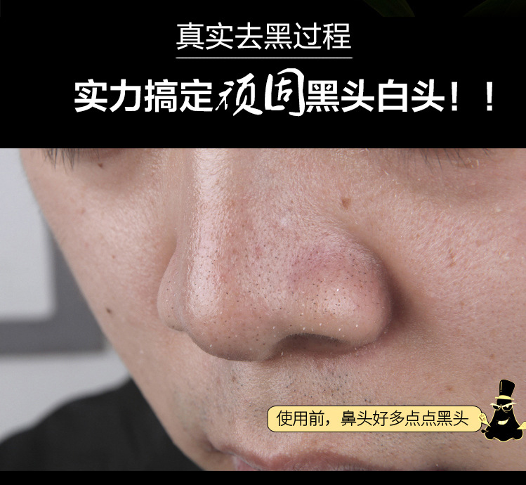 MUISUNGSHOP มาส์คโคลนลอกสิว โคลนพอกหน้าจมูกกำจัดสิวเสี้ยน ราคาประหยัด ขนาดพกพา 6g