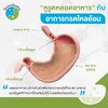 หูรูดหลอดอาหารกับอาการกรดไหลย้อน