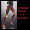 ปวดขาตามแนวของเส้นประสาท ?