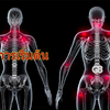 #ปวดเรื้อรัง กัดกร่อนคุณภาพชีวิต !